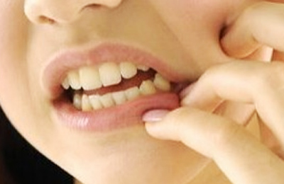 突發(fā)性、自發(fā)性的劇烈牙疼