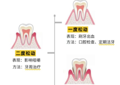 老年人牙齒松動了要怎么辦？