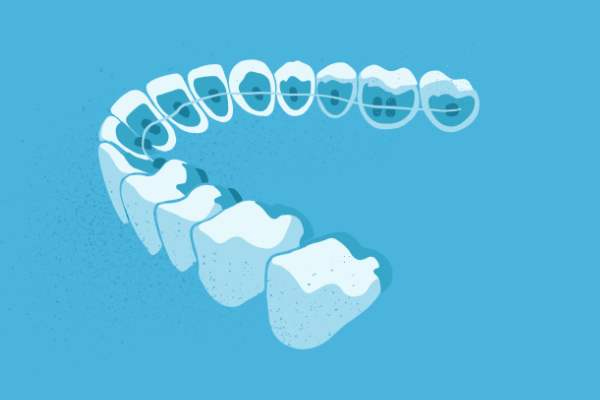 惟德口腔醫(yī)院口腔正畸好不好？